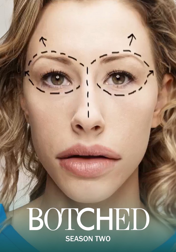 Botched Season 2 Watch Full Episodes Streaming Online 